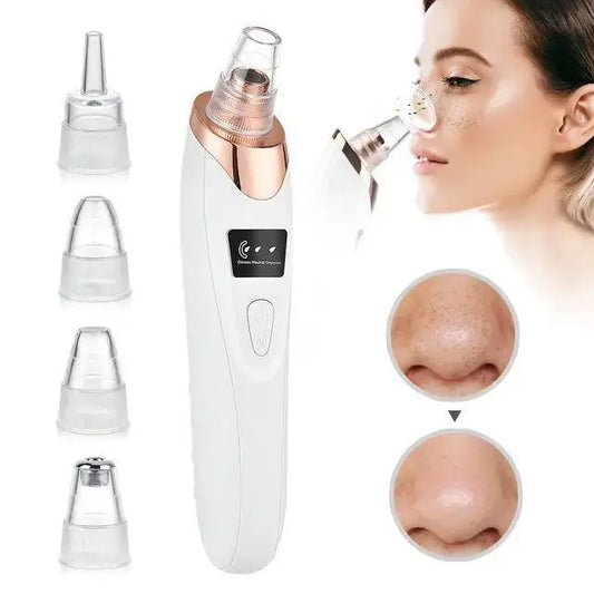 Trendyyx Derma Suction Blackhead Remover trendyyx