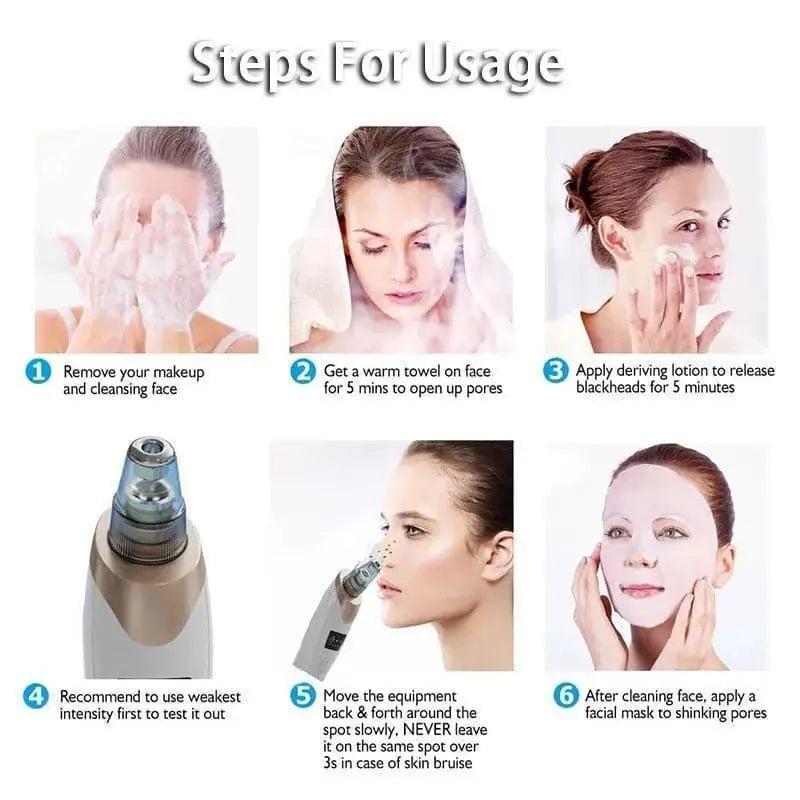 Trendyyx Derma Suction Blackhead Remover trendyyx